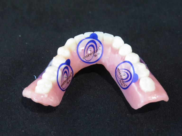 Placement of the SureMark markers Implant Concierge