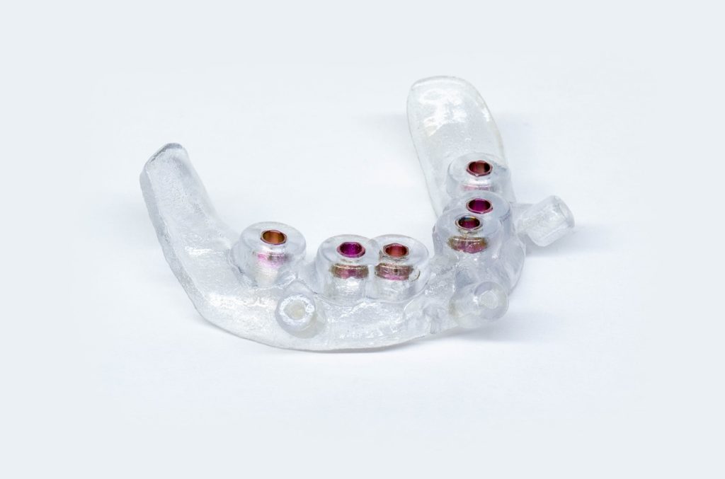 Implant Concierge Bone Borne Surgical Guide Dental Implants