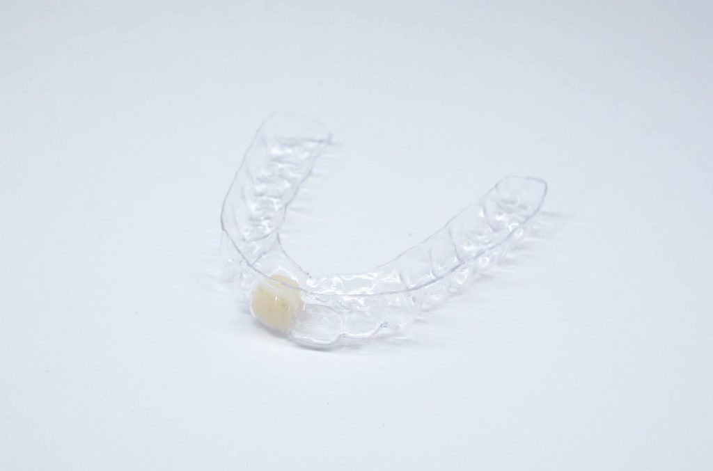 Implant Concierge Sofortprovisorium Essex Tray Chirurgische Anleitung für Zahnimplantate