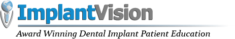 Guida chirurgica all'impianto dentale ImplantVision Medquip