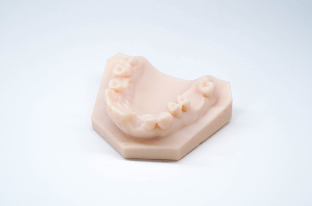 Modelo impreso en 3D implantes dentales cirugía guiada Impresión 3D