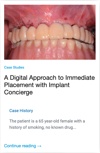 A digital Approach to immediate placement with implant concierge